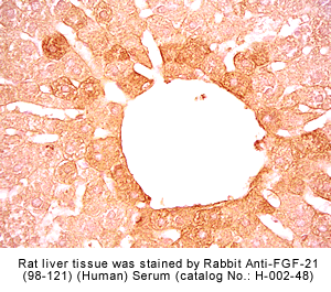 FGF-21 Immunohistochemistry