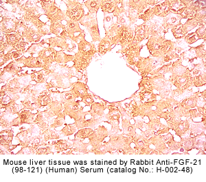 FGF-21, immunohistochemistry