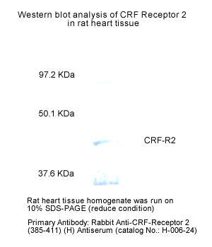 westernBlot