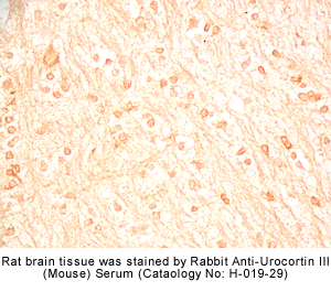 Urocortin III