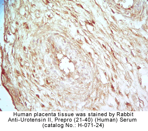 Urotensin II immunohistochemistry