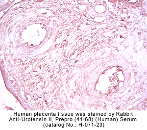 urotensin II