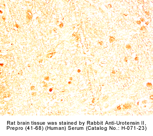 urotensin II