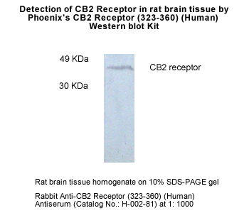 CB2