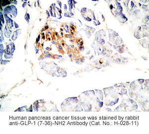 weight gain after stopping glp-1 GLP-1 Maintenance Strategy: Prevents Weight Regain After Weight Loss
