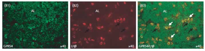 Co-localisation of GPR54 with LHbeta