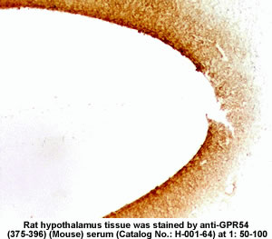 Rat hypothalamus was stained by anti-GPR54 (375-396) Mouse Serum