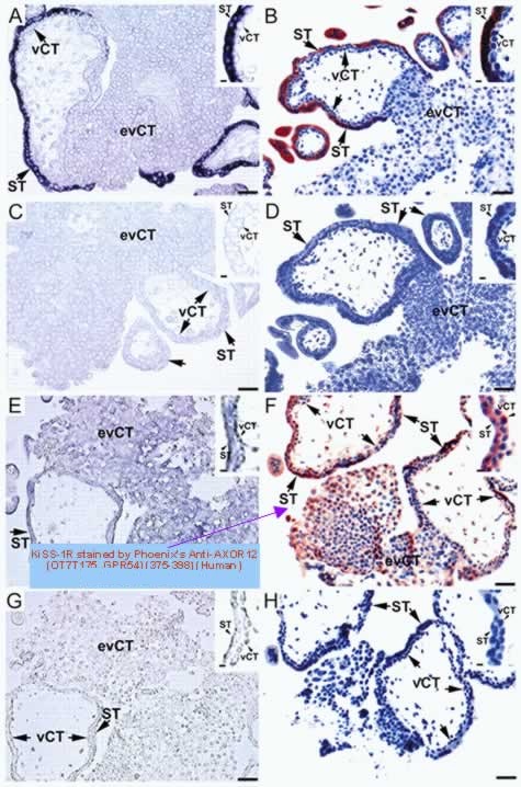 KiSS-1/Kp-54 and KiSS-1R localization in first trimester placenta.