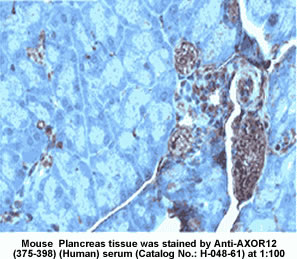 Mapping in Mouse Pancreatic tissue by Anti AXOR 12 (375-398) (Human) Serum