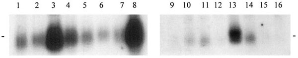 Northern blot analysis: NDUFV3