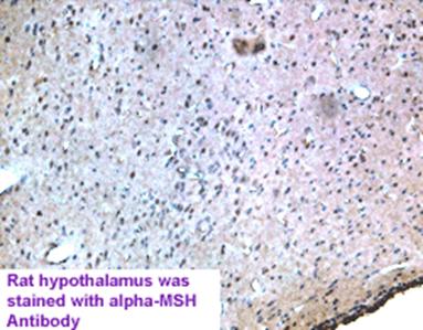 MSH, Alpha (Human, Rat, Mouse) - Antibody for Immunohistochemistry